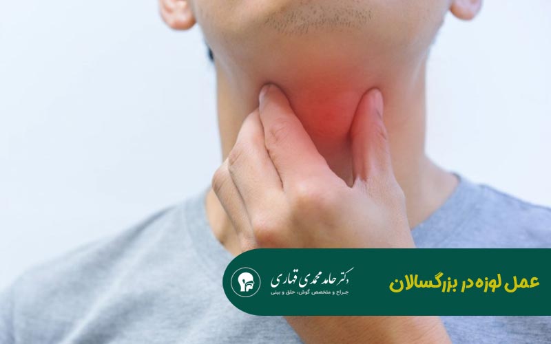 عمل لوزه در بزرگسالان